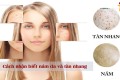 Cách nhận biết nám da và tàn nhang